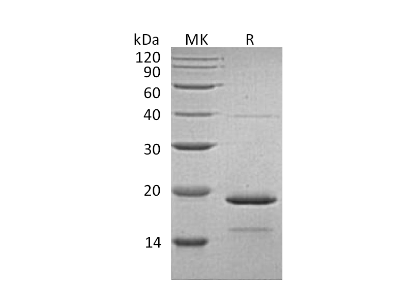Recombinant Human HSPB7 (C-6His)