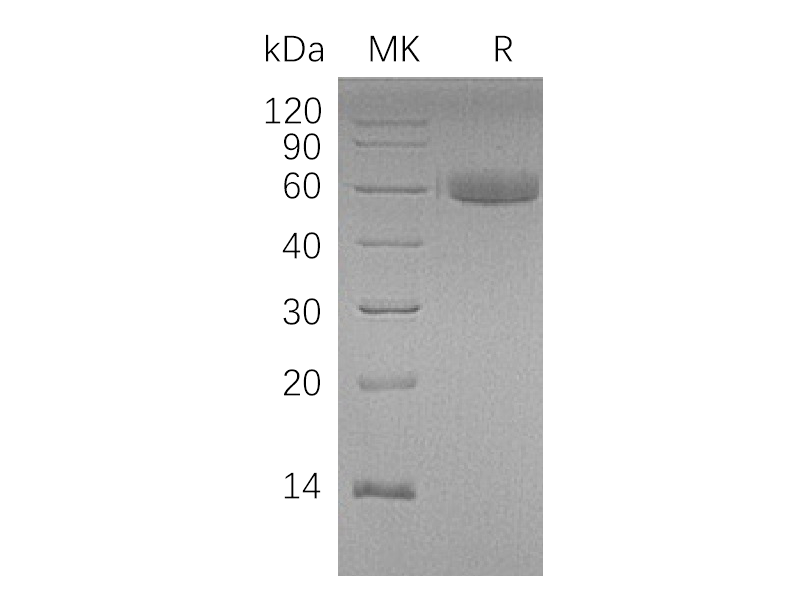 Recombinant Human HAO1 (N-Trx-6His)