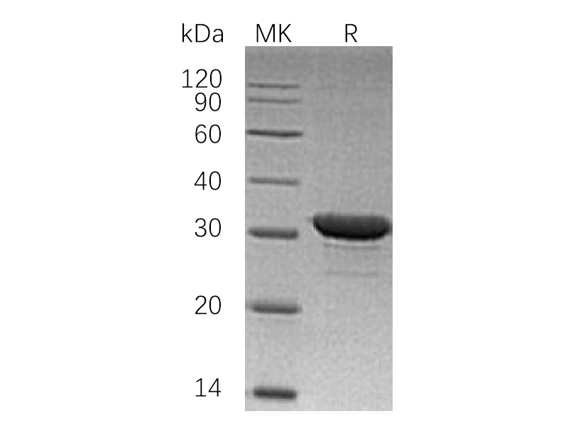 Recombinant Human IMPase1 (N-6His)