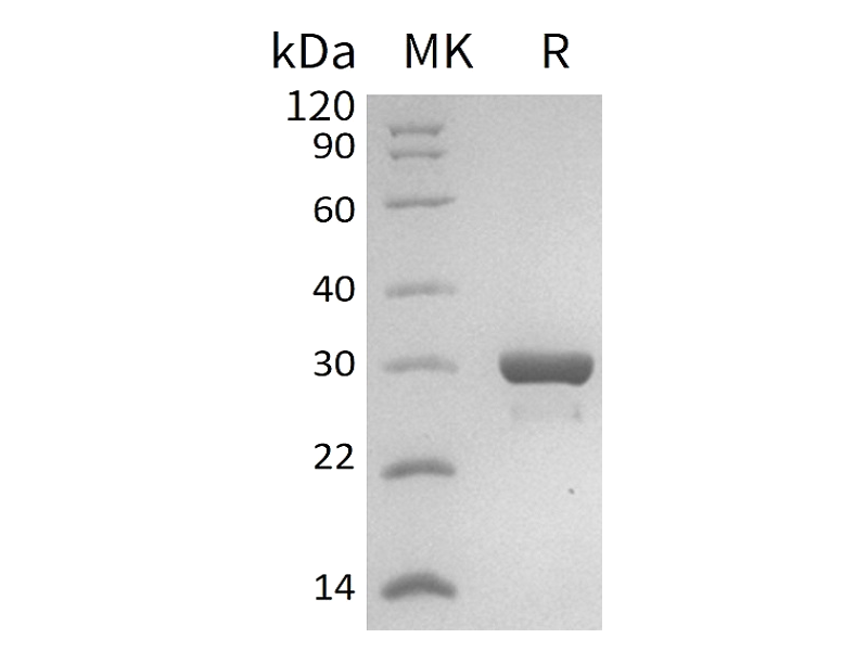 Recombinant Human IGF2BP-2 (N-T7 ,C-6His)