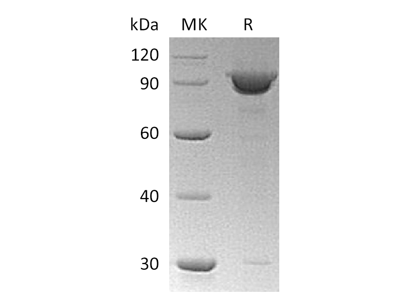 Recombinant Human KPNB1 (N-6His)