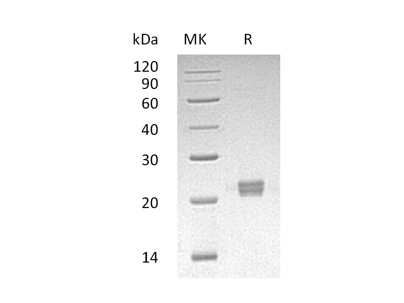 Recombinant Human ITPase (C-6His)