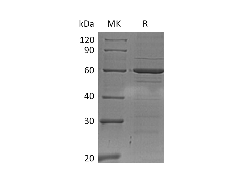 Recombinant Human IRF5 (C-6His)