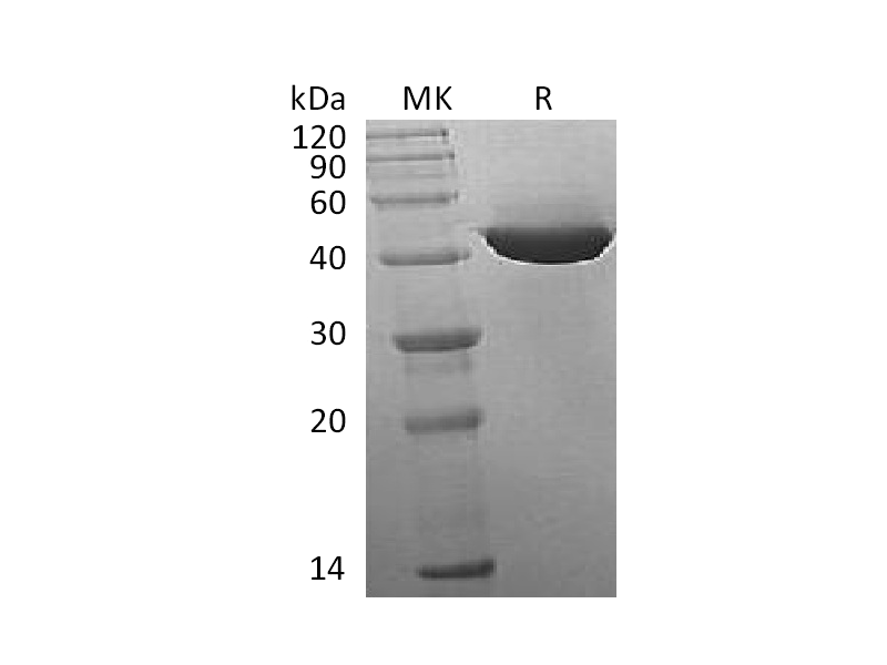 Recombinant Human IDH1 (C-8His)