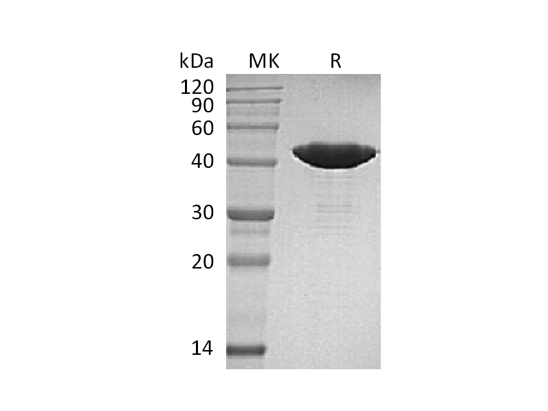 Recombinant Human IDH1 (R132H,C-8His)