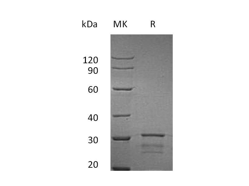 Recombinant Human Isomerase2 (N-6His)