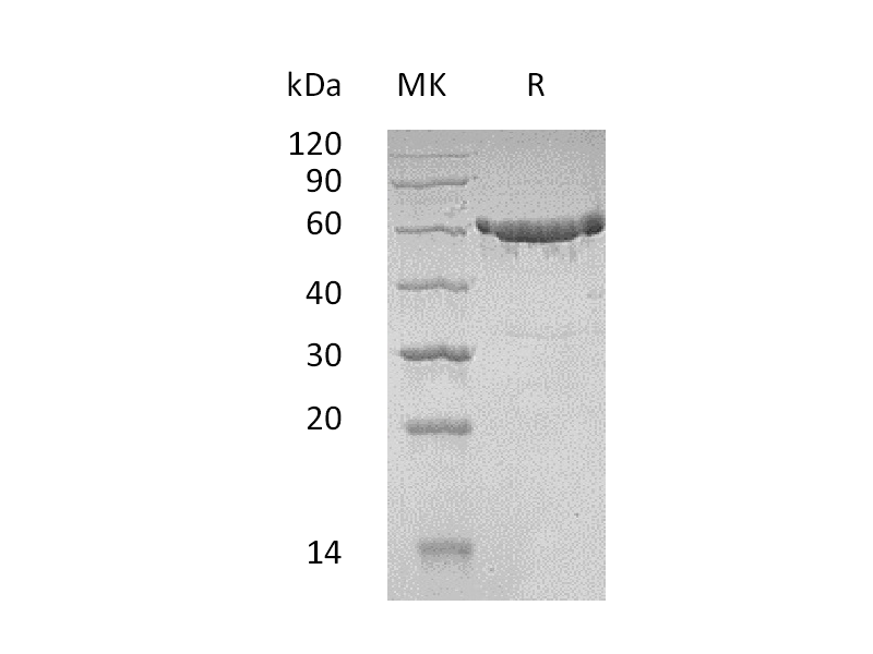 Recombinant Human KPNA2 (N-6His)