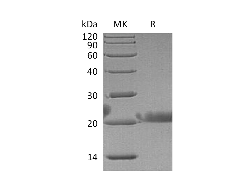 Recombinant Human LACRT (N-6His)