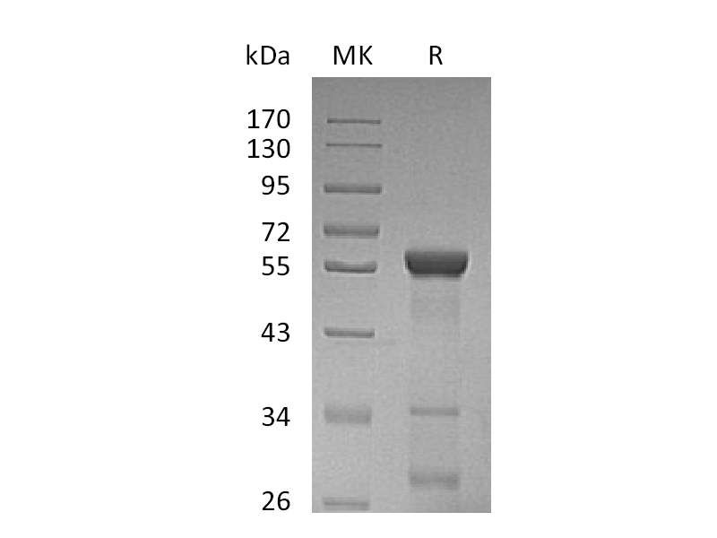 Recombinant Human LACTB2 (N-GST)