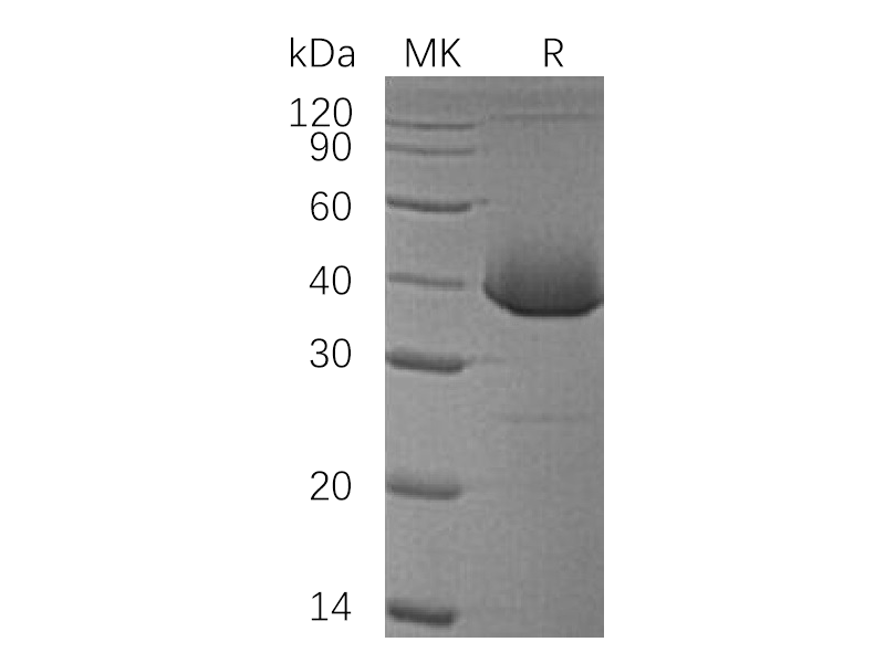 Recombinant Human LDH-B (N-6His)