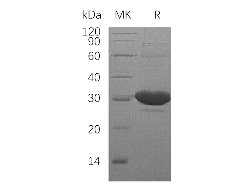 Recombinant Human DCXR (N-6His)