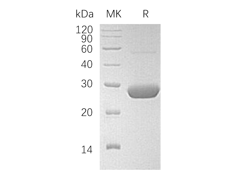 Recombinant Human LYPLA2 (C-6His)
