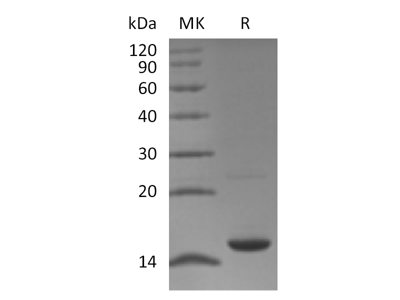 Recombinant Human MAP1LC3A (C-6His)