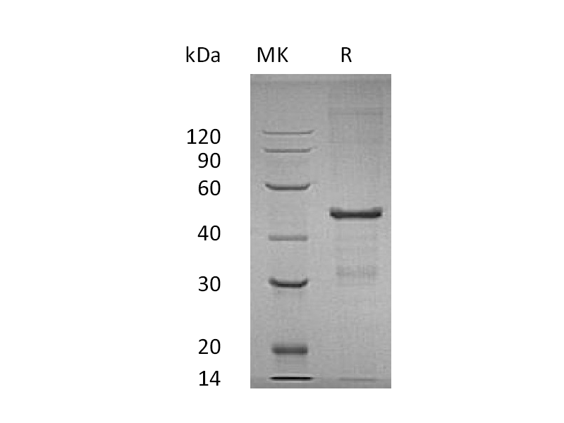 Recombinant Human MBIPP (N-6His)