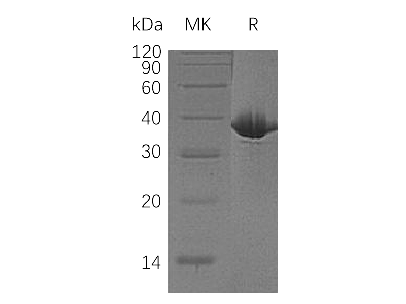 Recombinant Human MDH1 (C-6His)