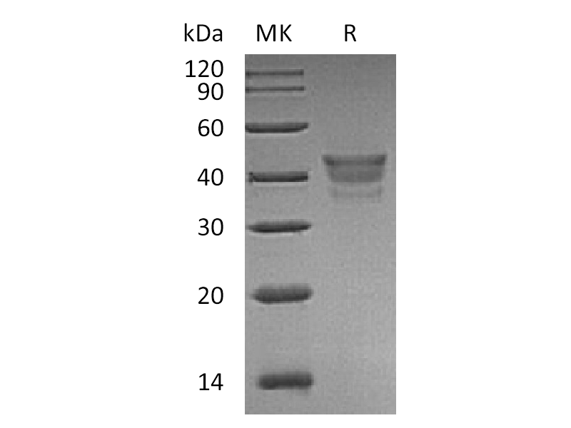Recombinant Human MetAP1