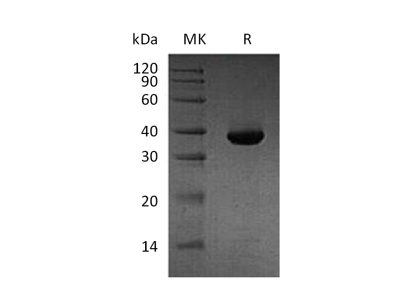 Recombinant Human MetAP1D (N, C-6His)