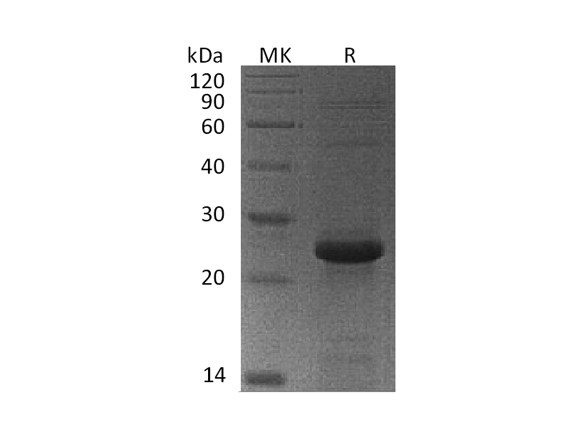Recombinant Human MGMT (N-6His)