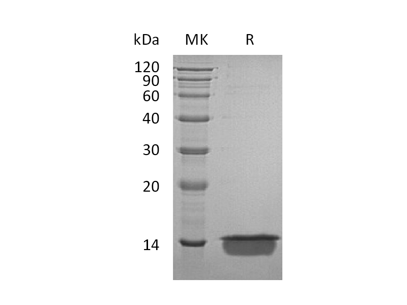 Recombinant Human MIA (C-6His)