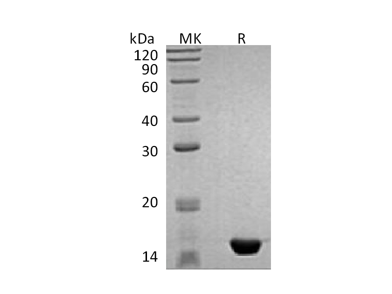 Recombinant Human MAP1LC3B