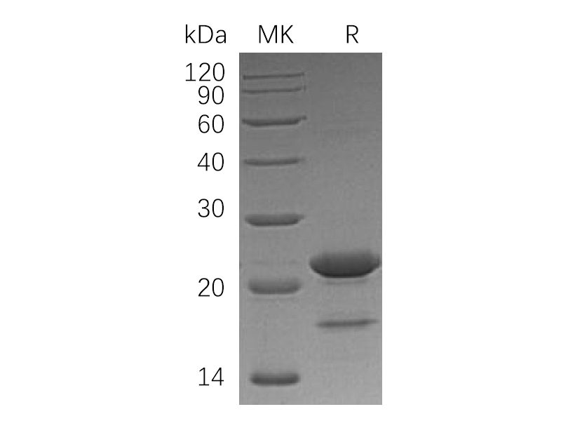 Recombinant Human ZBTB17 (N-6His)