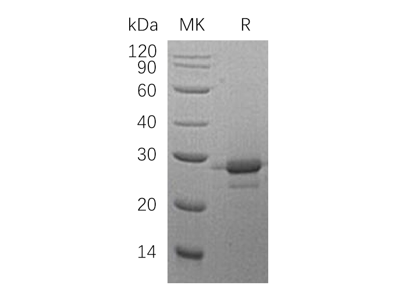 Recombinant Human MOB1A (C-6His)