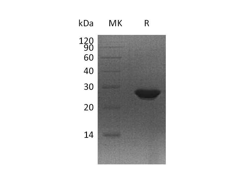 Recombinant Human MTHFS (C-6His)