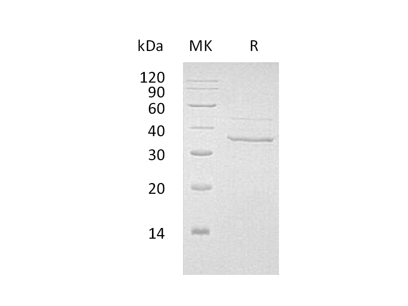Recombinant Human MYOZ2 (C-6His)