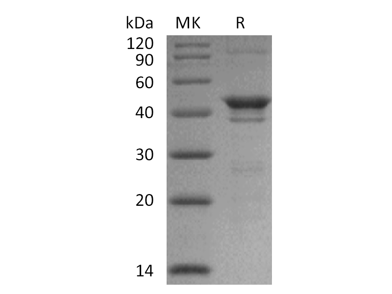 Recombinant Human NADK (N-6His)