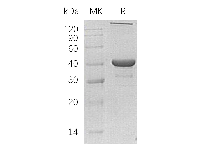 Recombinant Human NANS (N-6His)
