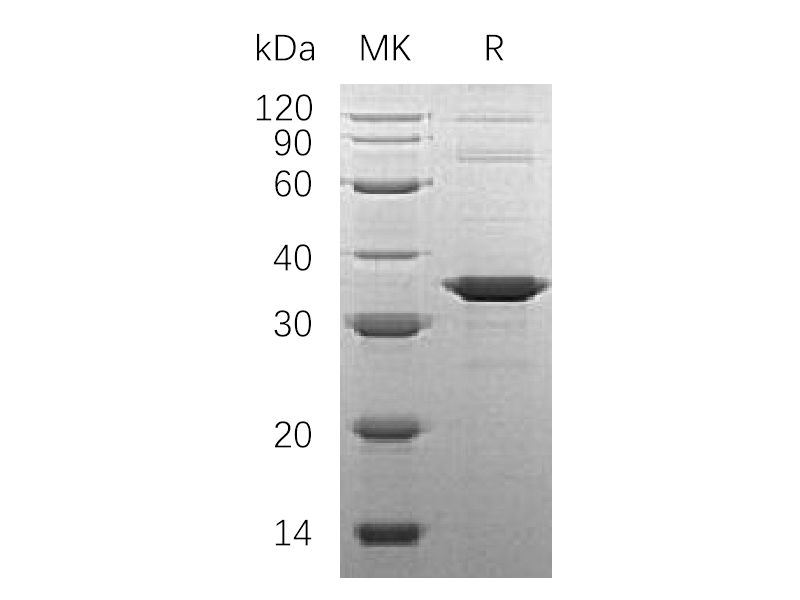 Recombinant Human SNAP- alpha (N-6His)