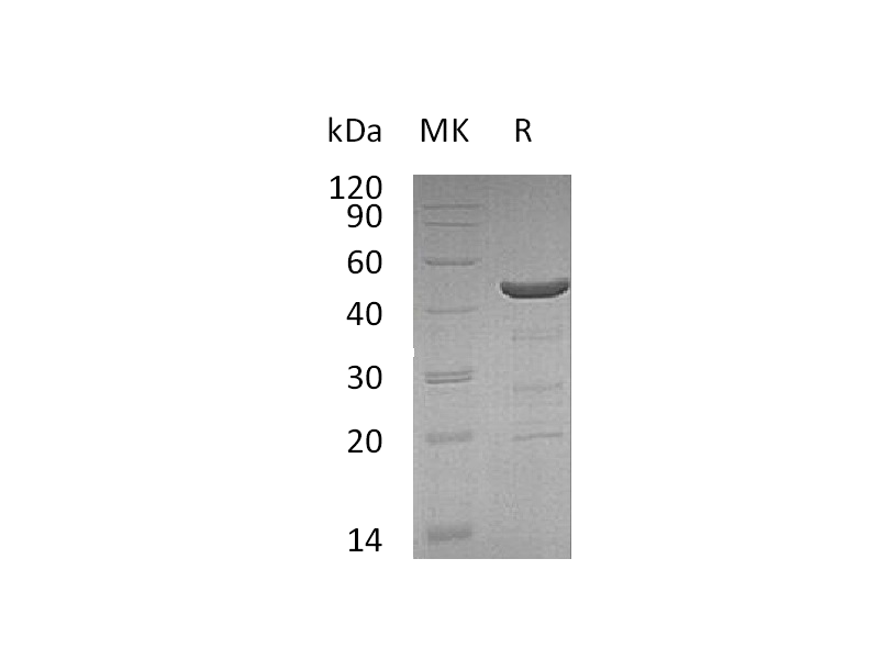 Recombinant Human NCF1 (C-6His)