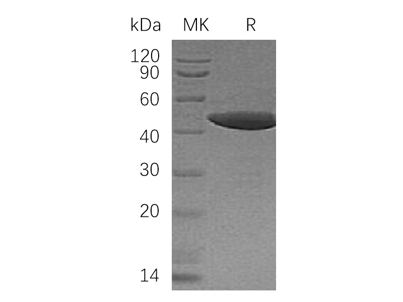 Recombinant Human NCK1 (N-6His)