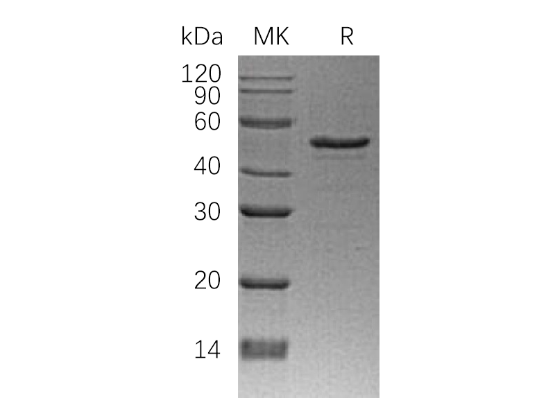 Recombinant Human NDRG1 (N-6His)