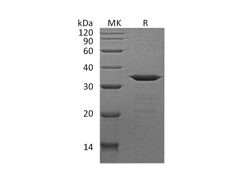 Recombinant Human NECAP2 (N, C-6His)