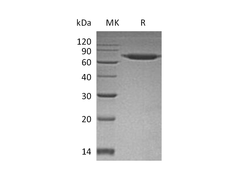 Recombinant Human SENP8 (N-6His)