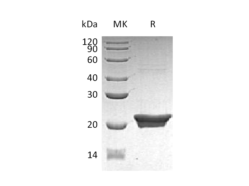 Recombinant Human NGAL (C-6His, E. coli)