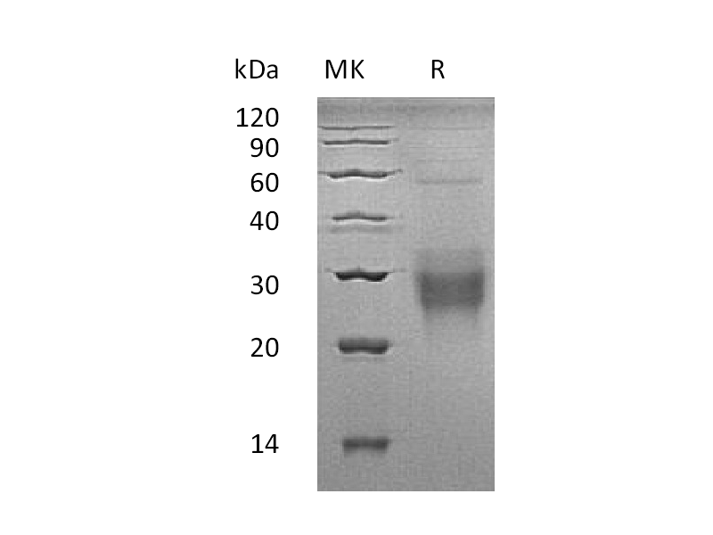 Recombinant Human NFYA (N-GST)