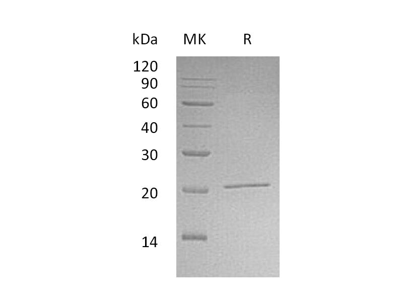 Recombinant Human NIP7 (N-6His)