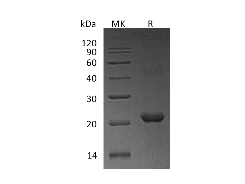 Recombinant Human NHP2 (N-6His)