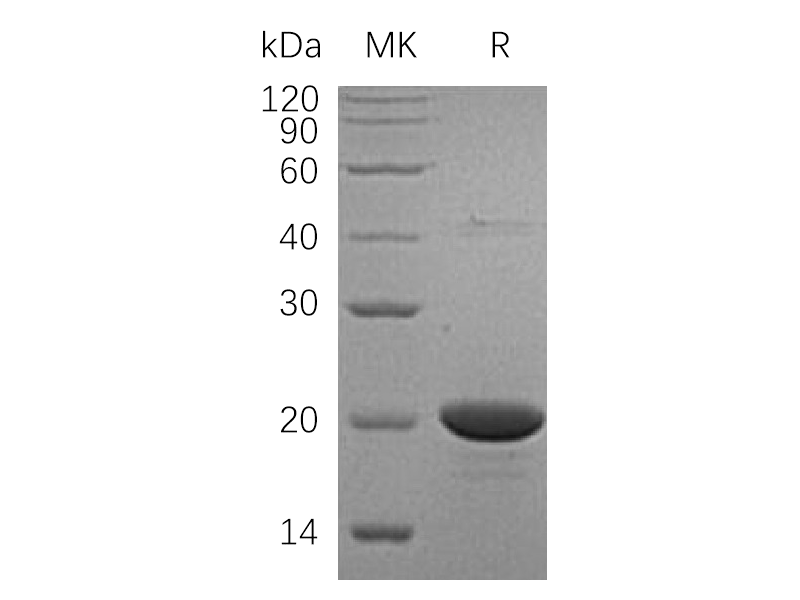 Recombinant Human NDPKA (N-6His)