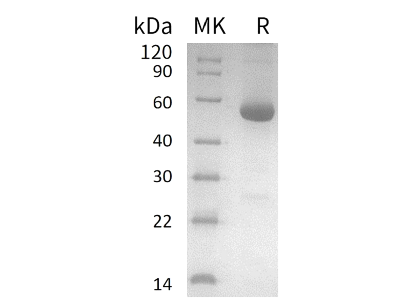 Recombinant Human ODC1 (C-6His, N-T7 tag)