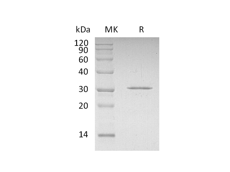 Recombinant Human CDKN1B (N-6His)