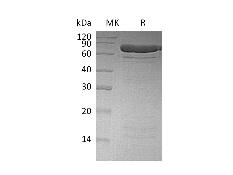 Recombinant Human PADI4 (N-6His)