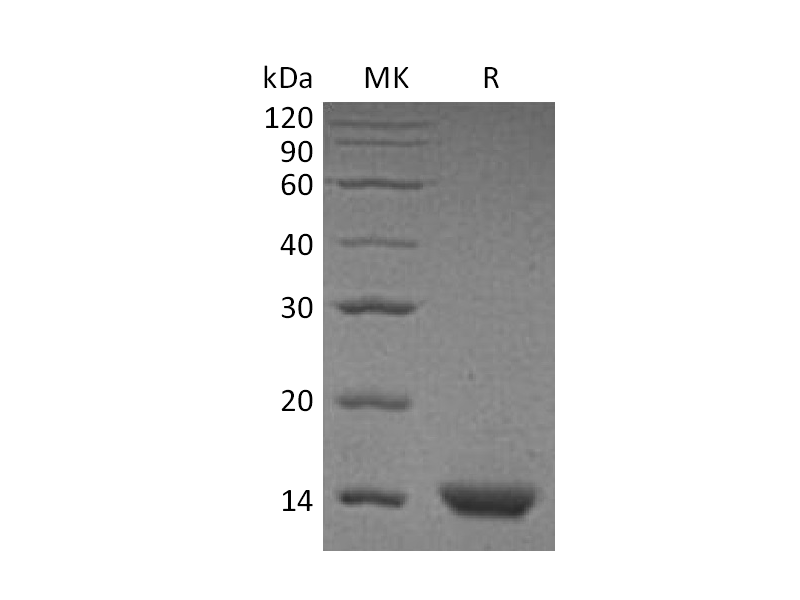 Recombinant Human PVALB (C-6His)