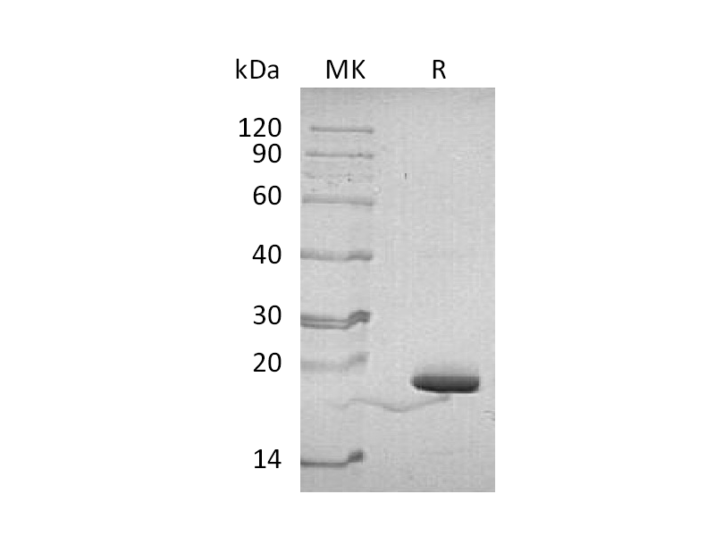Recombinant Human PIN4 (N-6His)