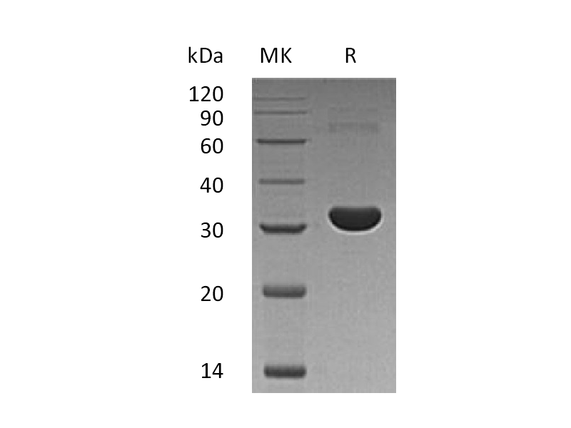 Recombinant Human PBLD (N-6His)