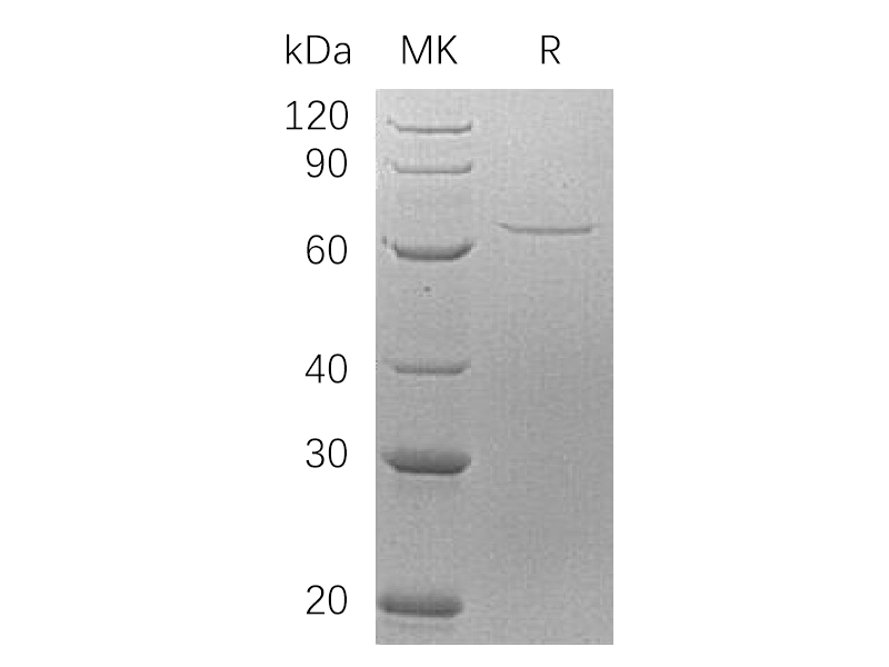 Recombinant Human AIF (N-6His)