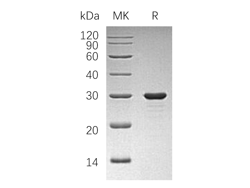 Recombinant Human PAP (N-6His)