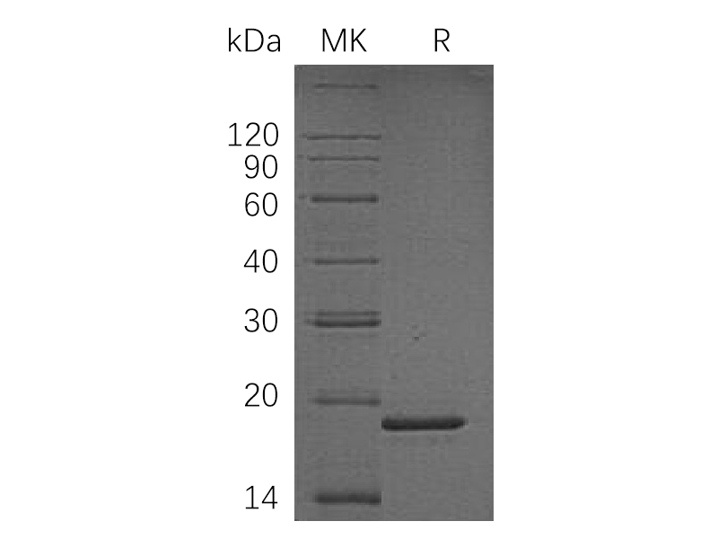 Recombinant Human PPIL1 (N-6His)